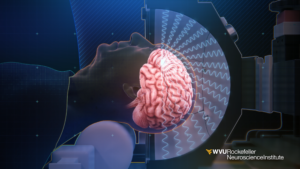 WVU's Ali Rezai talks about Rockefeller Neuroscience's groundbreaking ultrasound research and national media attention
